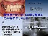 ssスライド26