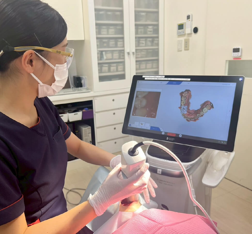 セレックシステム