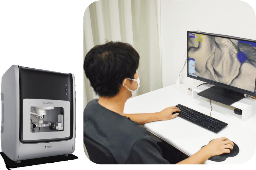 セレックシステム