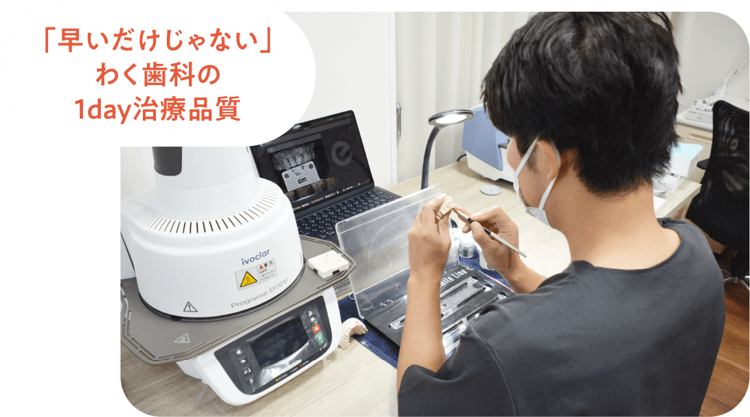 セレックシステム