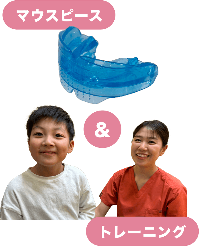 マウスピースでトレーニングを行う負担の少ない矯正治療です。
